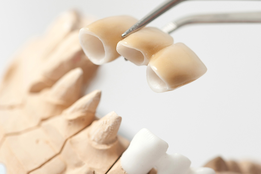 protesi dentaria